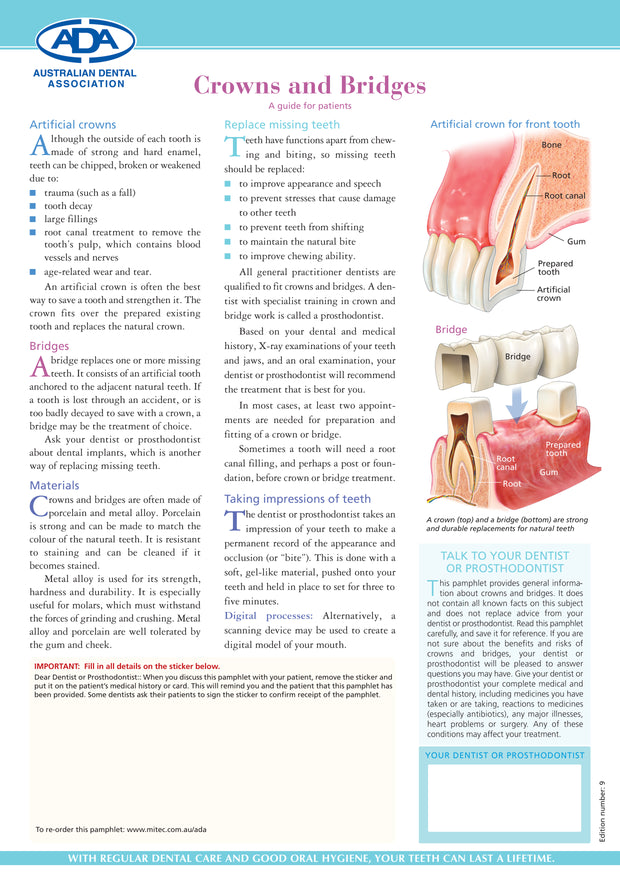Crowns and Bridges