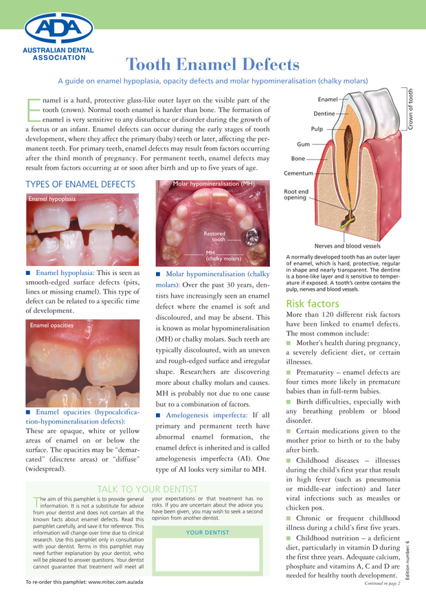 Tooth Enamel Defects