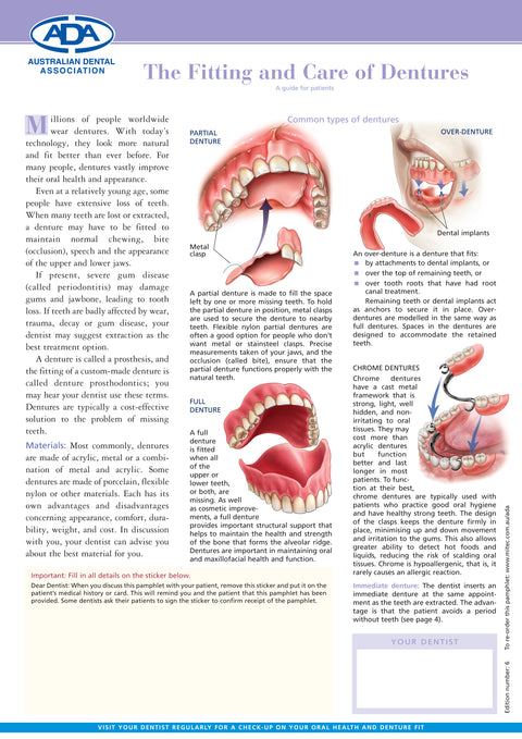 The Fitting and Care of Dentures