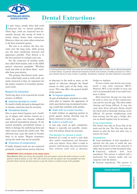 Dental Extractions