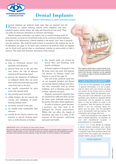 Dental Implants