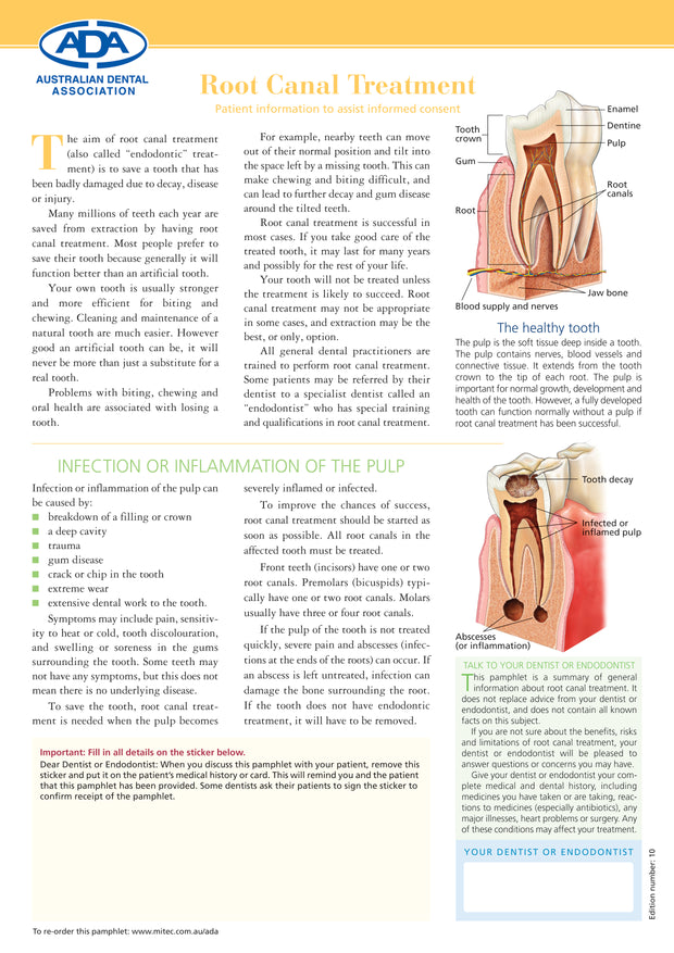 Root Canal Treatment