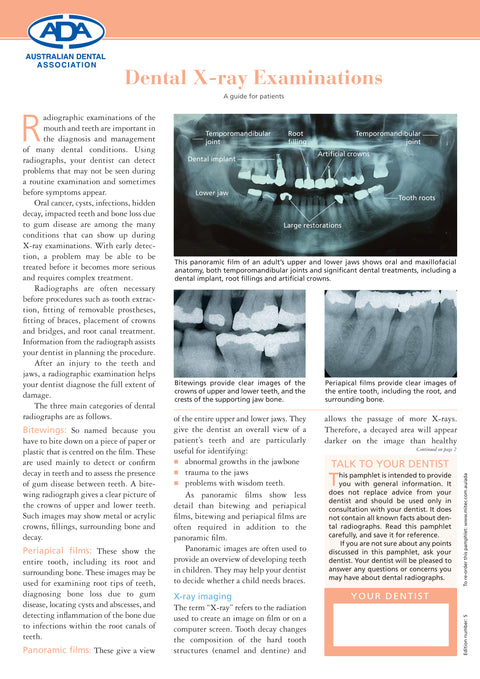 Dental X-Ray Examination