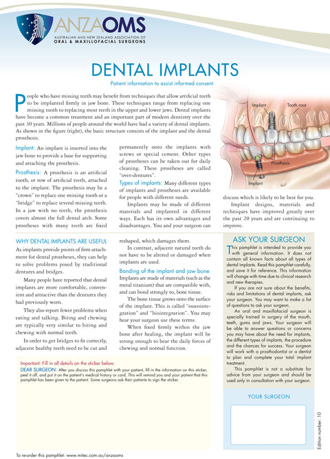 Dental Implants