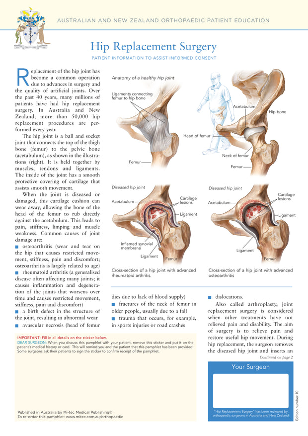 Hip Replacement Surgery