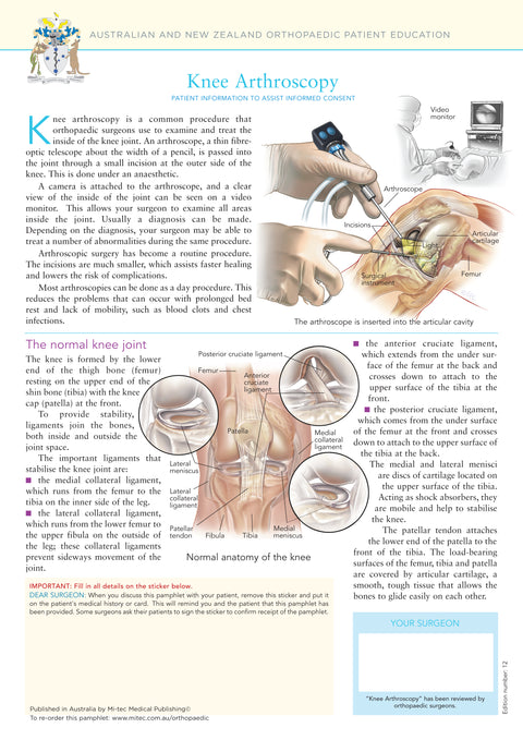 Knee Arthroscopy