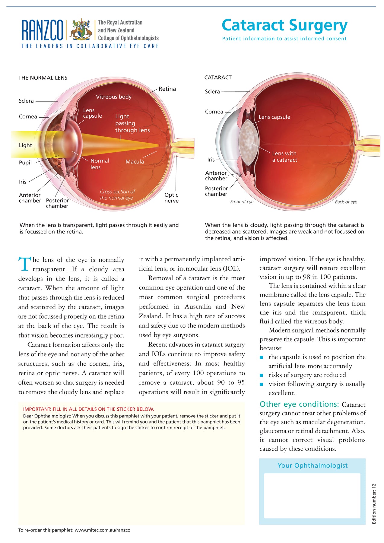 Cataract Surgery – Mi-tec Medical Publishing