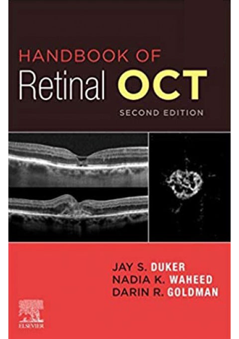 Handbook of Retinal OCT: Optical Coherence Tomography – Mi-tec ...