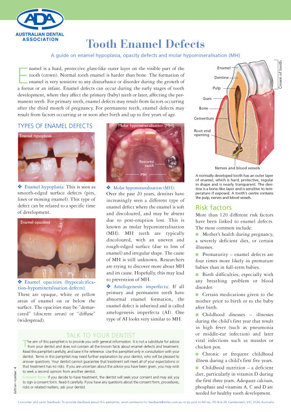 Tooth Enamel Defects – Mi-tec Medical Publishing