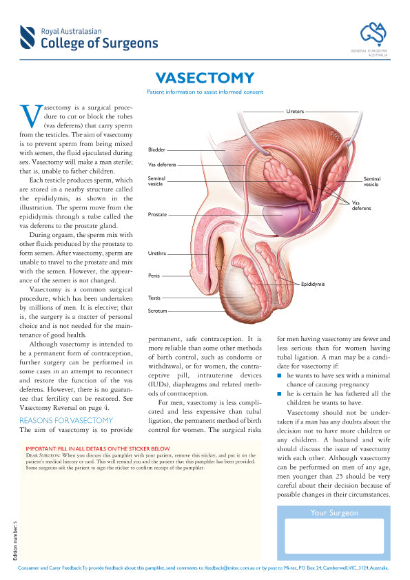 Vasectomy Information